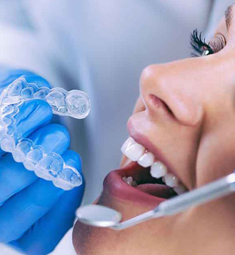 Invisalign Treatment Process