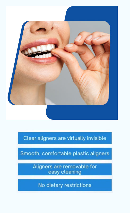 Invisalign Treatment