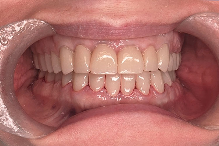 Cosmetic Dental Treatment - After Image