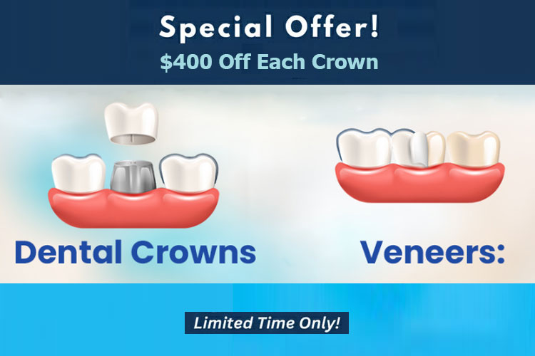 Crown & Veneer Special Offer
