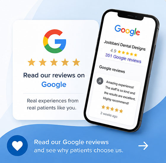 Google Review