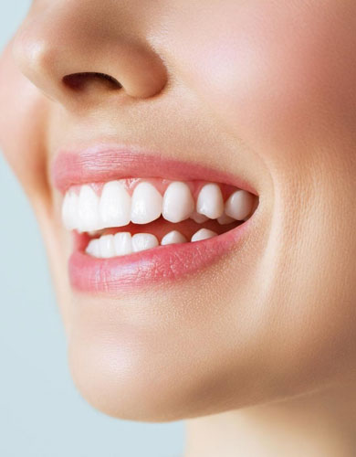 Dental Crown & Veneer Special Offer