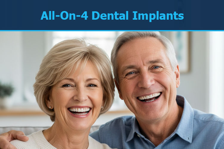 All-on-4 Dental Implants