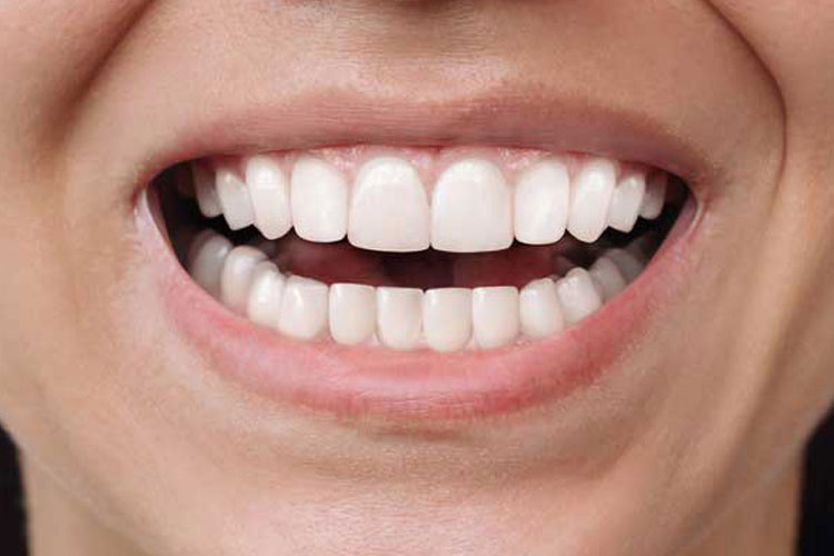 Invisalign Treatment - After Picture