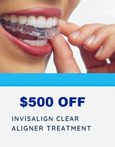 Invisalign Discounted Treatment