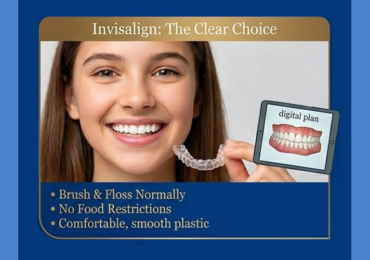 Invisalign for Teens