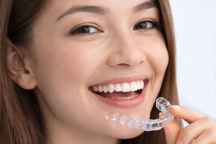 Overbite Treatment (Invisalign)