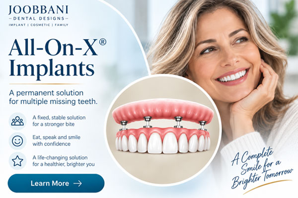 All-On-X-Implant Treatment