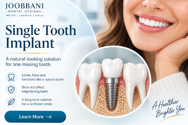 Single Tooth Treatment